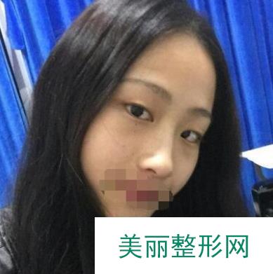 [点评]广州中山大学附属整形医院好吗？医生名单丨整形案例~