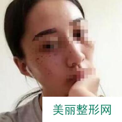 [点评]无锡中医院整形科好不好？附医生名单和整形案例~