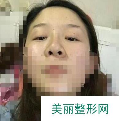 [点评]沈阳军区总医院美容整形科怎么样？附医生名单&整形案例