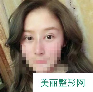 [点评]沈阳军区总医院美容整形科怎么样？附医生名单&整形案例