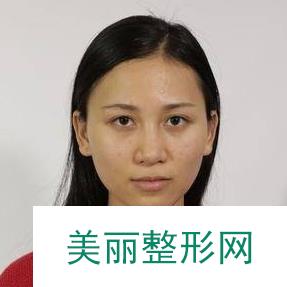 [实力评价]北京大学人民医院怎么样？内附医生名单和整形案例~