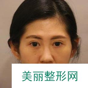 [实力评价]盛京医院美容科怎么样？内含热门项目价格表及案例~