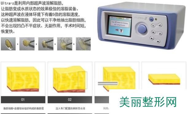 成都威塑吸脂医院哪家好？面吸真实术后反馈~