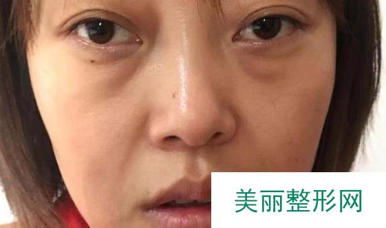 襄阳中心医院有美容科吗？附医生名单丨整形案例图集~