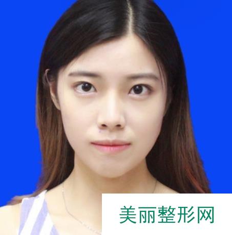 北京惠合嘉美医院是正规医院吗？专家列表/真人眼鼻整形案例~