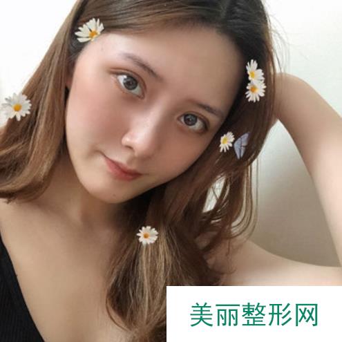 上海臻妮医疗美容靠谱吗？坐诊医生实力+自体丰胸案例~