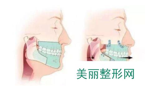 天津口腔医院正畸很贵吗