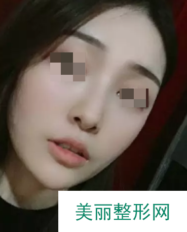 武汉天佑医院医美靠谱吗