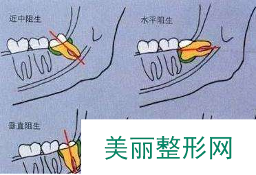 西安口腔医院排名