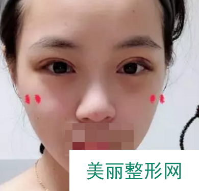 天津第一中心医院美容整形案例经典