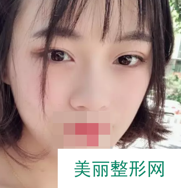 天津第一中心医院美容整形案例经典