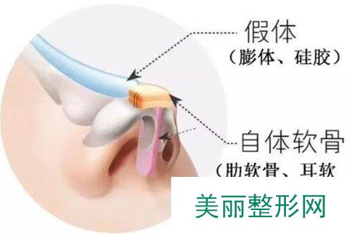 西安市第四医院美容科口碑