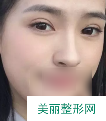 吉林大学第一医院整形美容科