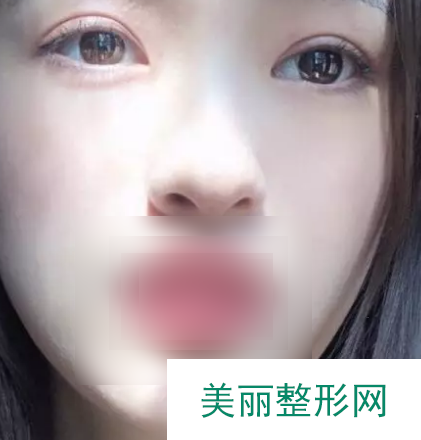 吉林大学第一医院整形美容科