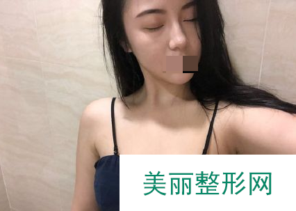 中山大学附属第一医院整形美容科价格表