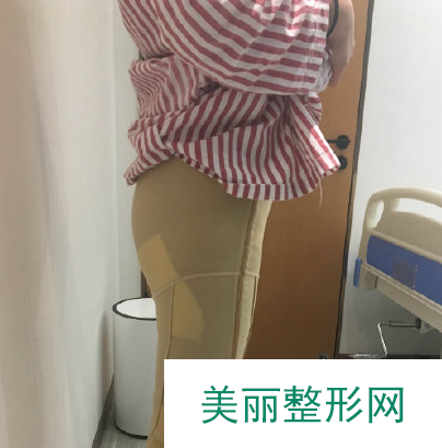 徐州矿总医院整形科怎么样