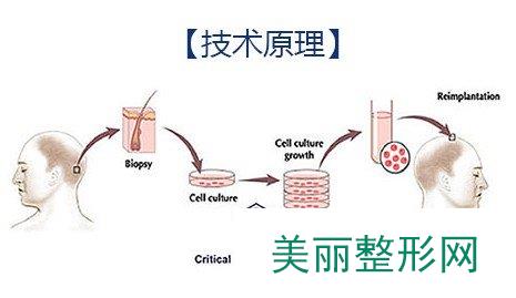 广州华美植发果公开