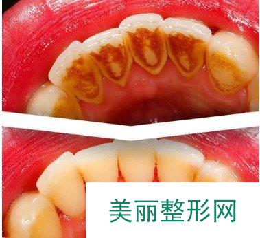 赣州贝壳口腔怎么样