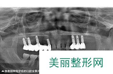 重庆美奥口腔正规吗