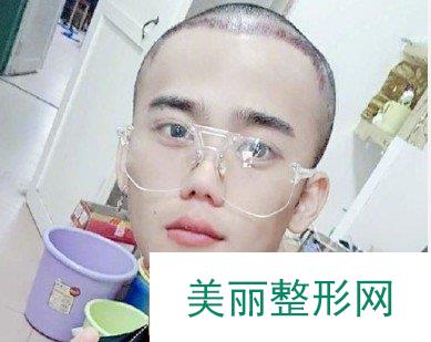 广东省人医植发怎么样