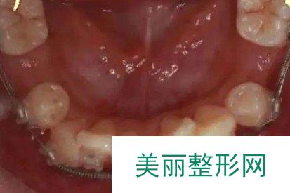 荷马口腔医院怎么样