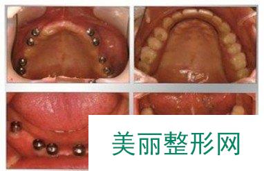 兴文微笑口腔怎么样