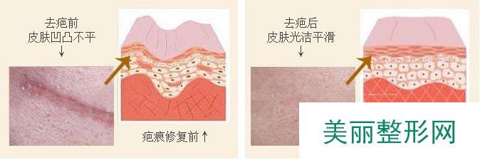 成都军区总医院整形外科怎么样