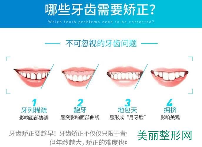 上海第九人民医院牙齿矫正多少钱？价格表+案例图