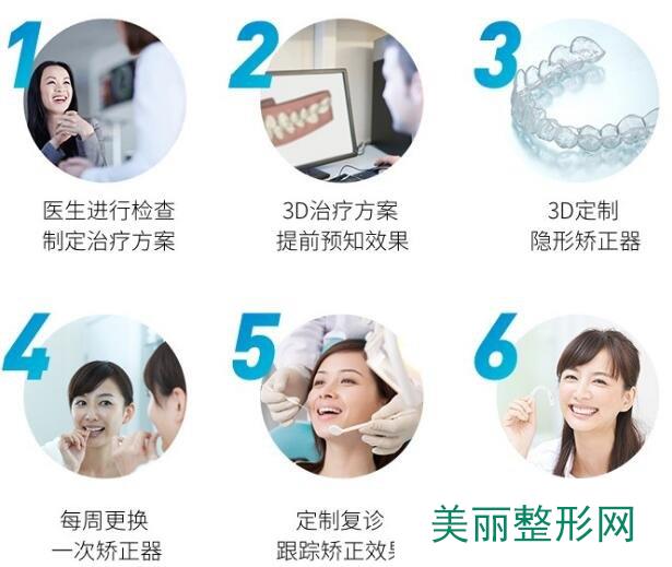 上海第九人民医院牙齿矫正流程