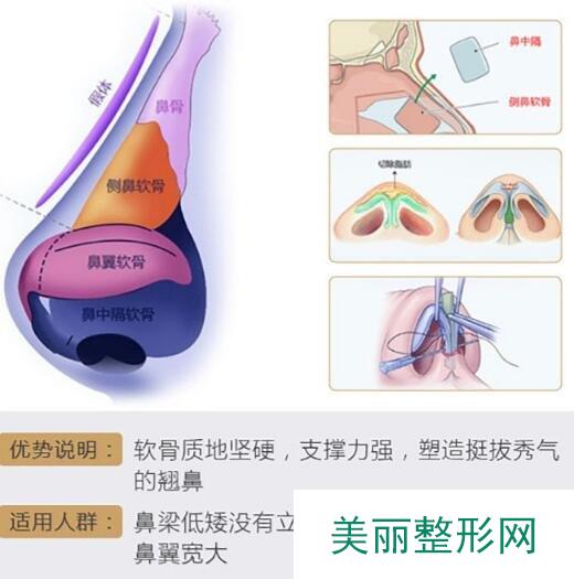 广州荔湾人民医院鼻子整形