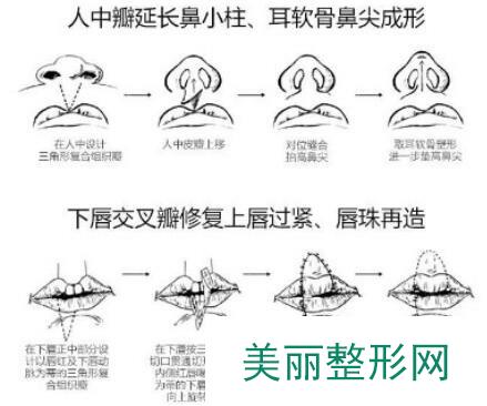 项目推荐医生