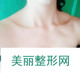 重庆军美，曾令宇，隆胸，案例