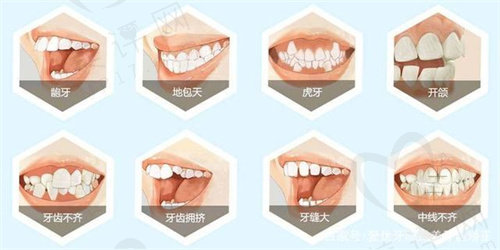 成都新桥口腔牙齿矫正