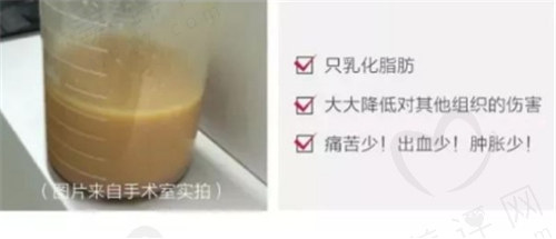 “脂肪选择性”定向乳化脂肪，损伤小、恢复速度快