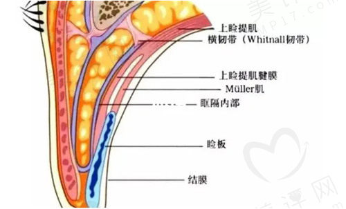 做埋线双眼皮术后恢复注意事项