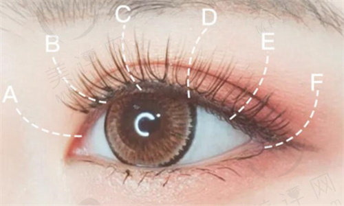 济南诺德翘睫美瞳术口碑好