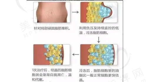 酷塑减脂过程