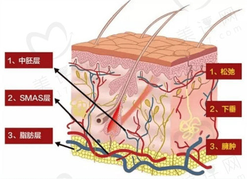 北京黄寺杜太超小切口面部提升术