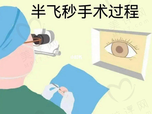 武汉佰视佳眼科近视手术怎么样