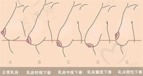 花苞精Diao术和棒棒糖法缩胸哪个更好？