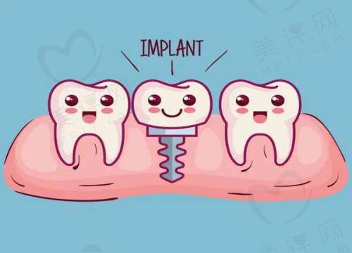 上海迈维牙齿种植