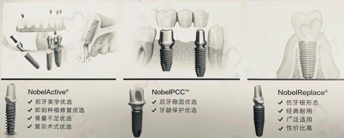 牙博士口腔医院怎么样预约挂号呢