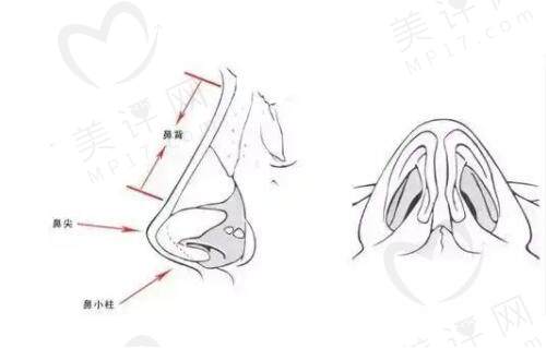 重庆李喆医生做鼻子多少钱