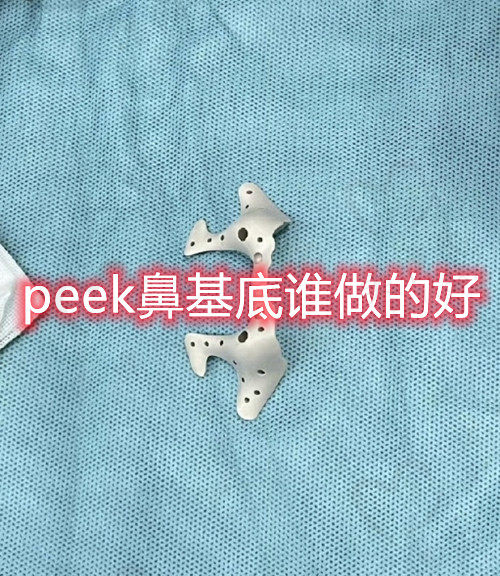 peek鼻基底做的好的医院和医生