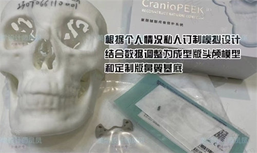 武汉做peek鼻基底的医院