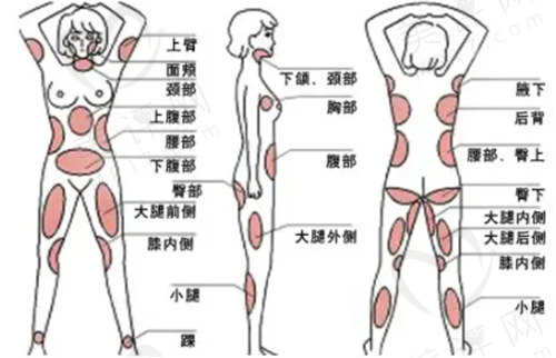 西安国医中心医院吸脂口碑怎么样