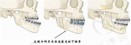 穆雄铮医生能做正颌手术吗