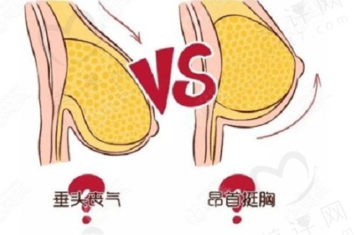 乳房下垂矫正的方法有哪些