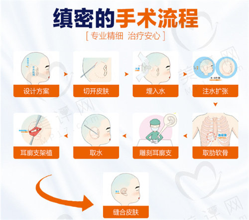 毋巨龙耳再造术例