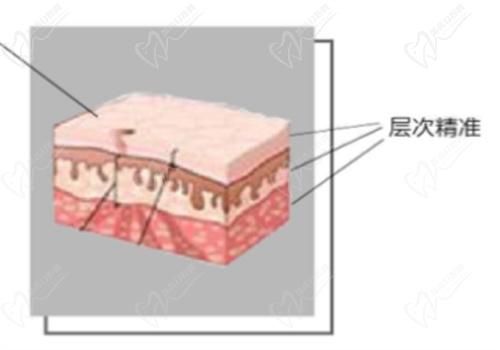 上海薇琳抽脂成效好